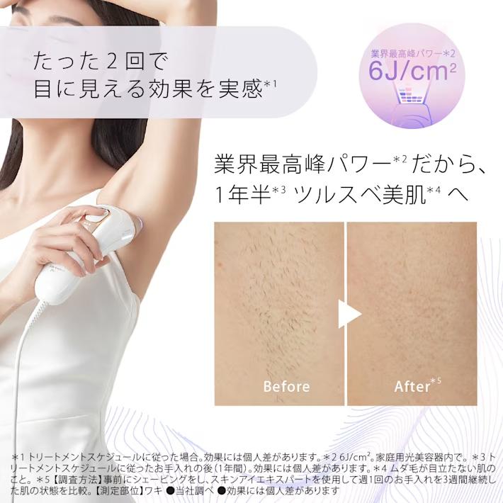 コードレス脱毛器 充電器付き 値引き交渉可能 シルクエキスパート 【4/3新発売！】脱毛器・光美容器を手掛ける