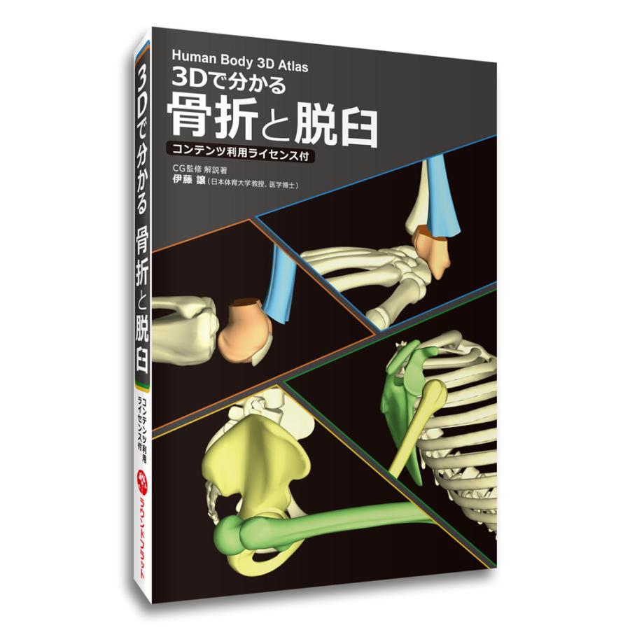ソフトウェア 「3Dで分かる 骨折と脱臼 コンテンツ利用ライセンス付 