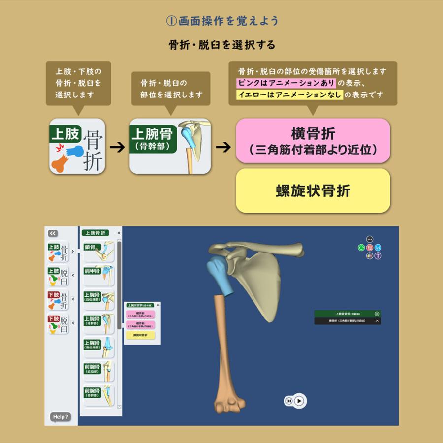 ソフトウェア 「3Dで分かる 骨折と脱臼 コンテンツ利用ライセンス付 