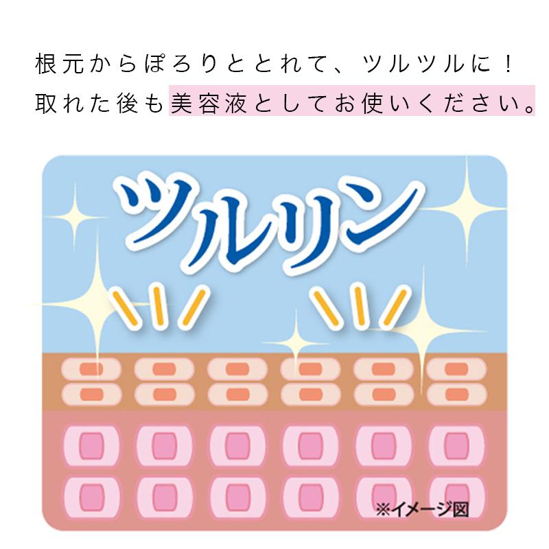 イポロン L イボ 除去 イボケア イボ取り オイル いぼ取りクリーム 首 顔 送料無料 老人 いぼ 薬 首イボ取りクリーム イボ ハトムギ gl-063-15ml｜mutenpo-depato｜15