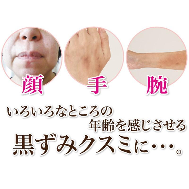 シミ取りクリーム 顔 シミ取り シミ消し 気になる部分にシミ込む シミ取りクリーム 顔 シミ取り シミ消し 気になる部分にシミ込む