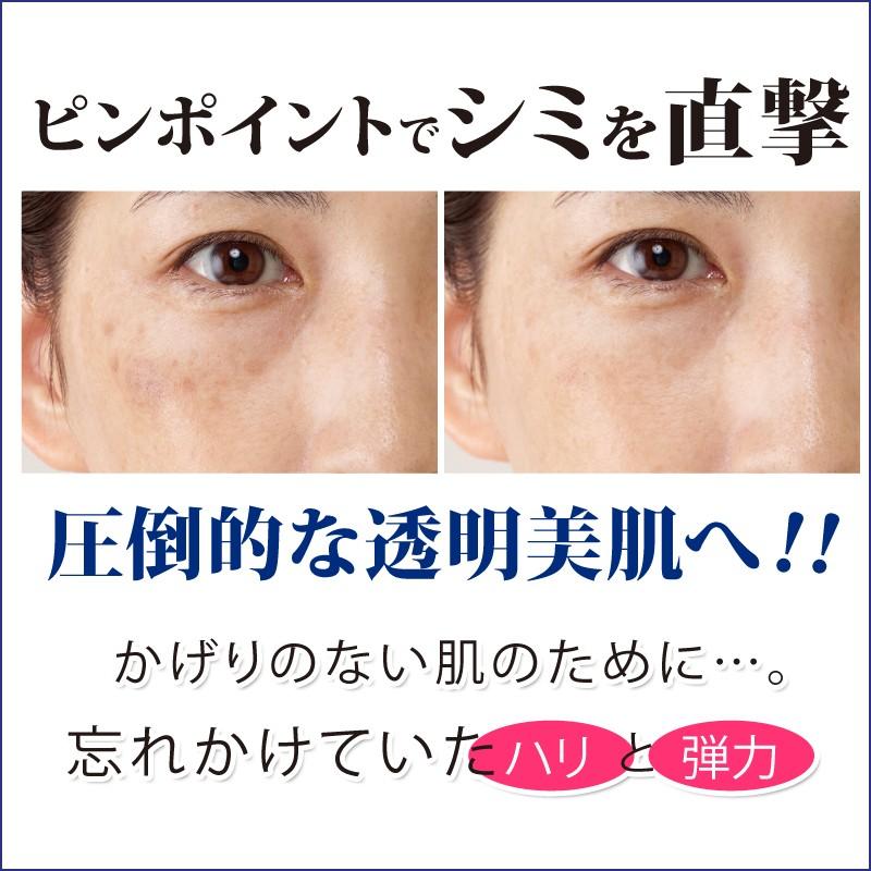 シミ しみ取り 医薬部外品 シミ取りクリーム トラネキサム酸 シミ しみ取り 医薬部外品 シミ取りクリーム トラネキサム酸