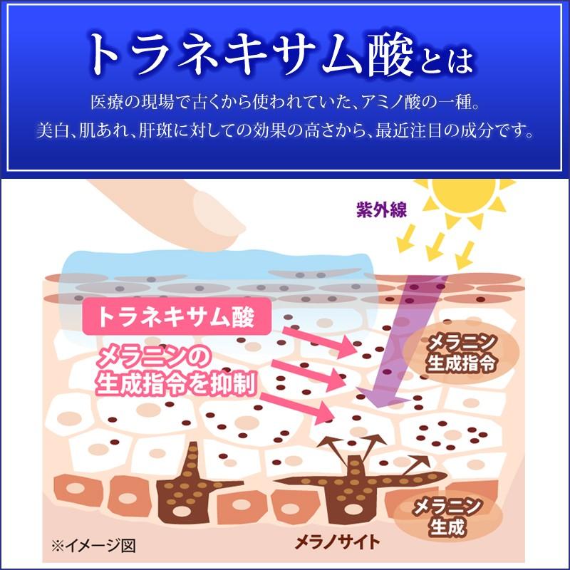 シミ しみ取り 医薬部外品 シミ取りクリーム トラネキサム酸 シミ しみ取り 医薬部外品 シミ取りクリーム トラネキサム酸