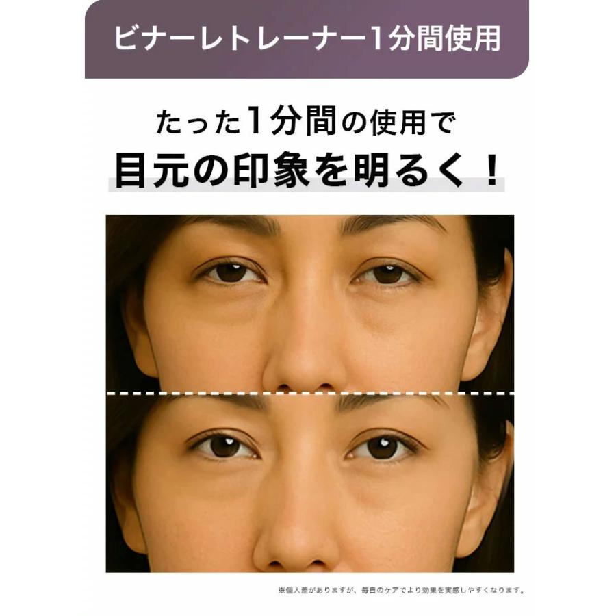 目元美顔器 目元ケア 目元マッサージ 目元 リフトアップ 目元エステ