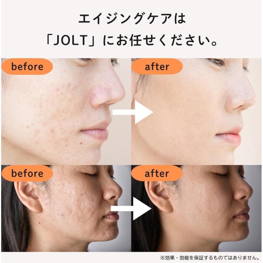 1,000円offクーポン】 JOLT オールインワン美容液 30ml【エクソソーム