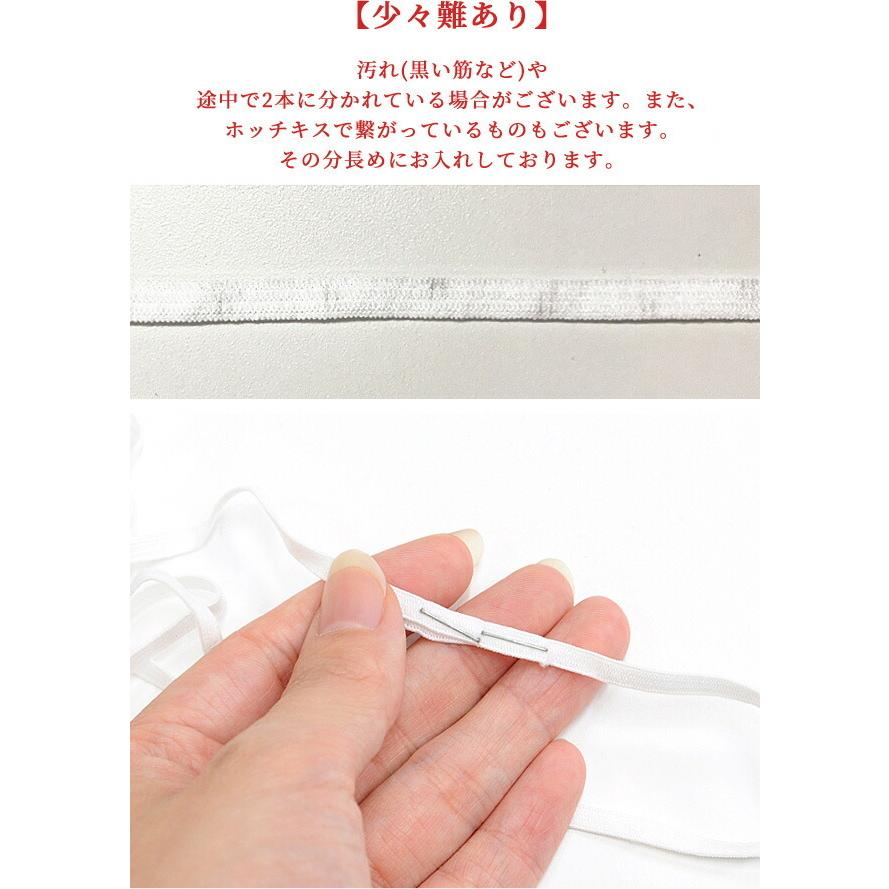 爪 に 黒い 縦 線 が 入る
