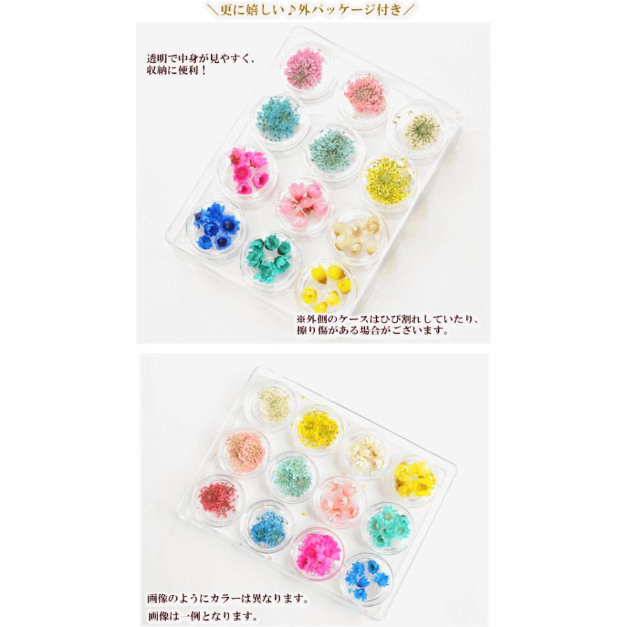 MY mama ドライフラワー レース ＆ スターフラワー アソートセット