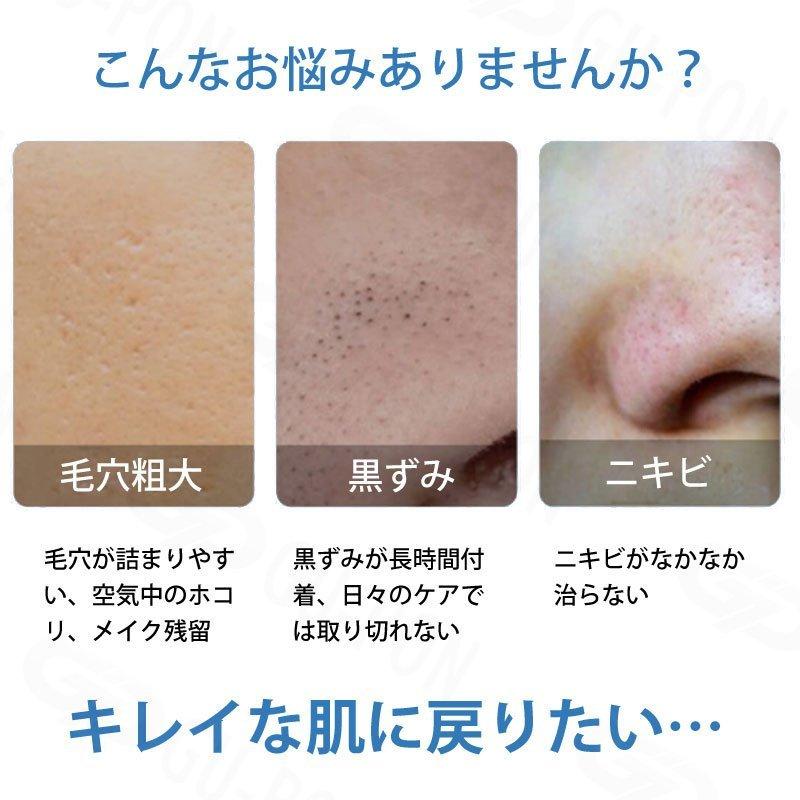 毛穴吸引器 口コミ 毛穴ケア いま注目の美容アイテム メンズ 角栓除去 美顔器 黒ずみ 鼻 いちご鼻 クレンジング Ems 効果 毛穴 毛穴クリーン 簡単操作 Amyi34 マイヴィタァライフ 通販 Yahoo ショッピング