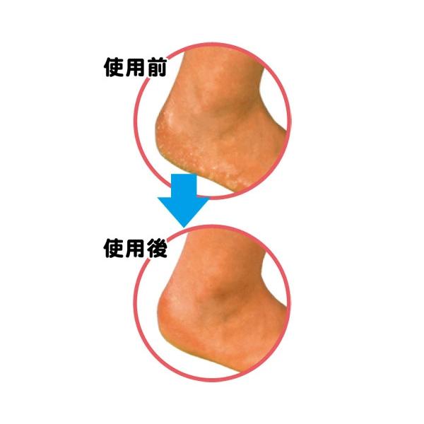 【定形外郵便】ミノウラ　足指小町 角質用　かかとつるつる　シルクハードスポンジ１個　＜足のガサガサに　角質化した皮膚を滑らかにする＞｜n-yakuhin｜03