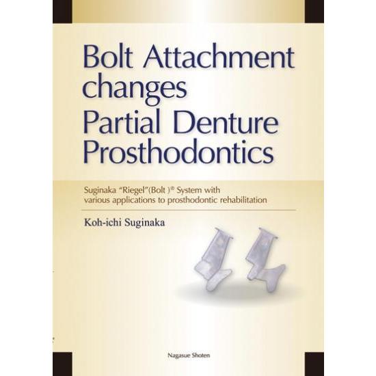 Bolt Attachment changes Partial Denture Prosthodontics
