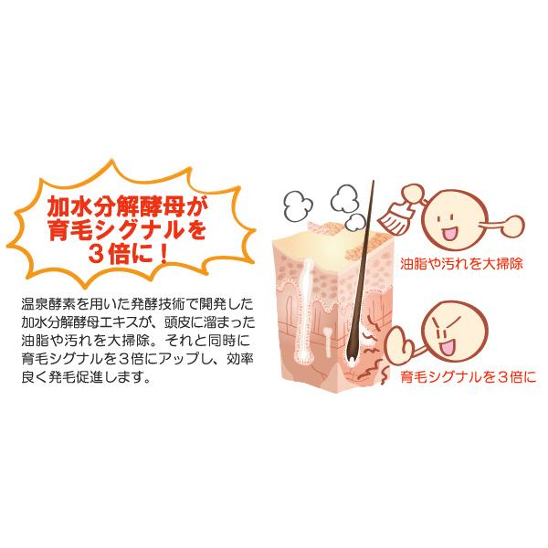 M-1 育毛ローション(医薬部外品)エムワン M1 育毛剤 120ml M-1 育毛ローション(医薬部外品)エムワン M1 育毛剤 120ml