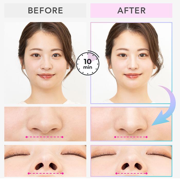 正規品 ルクセア フォーネスプロ LUXCEAR 鼻専用美顔器 Fornez PRO 鼻