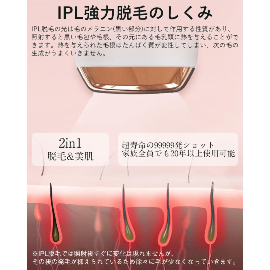 脱毛器 女性 メンズ vio対応 IPL光脱器 99万回 5段階 美肌 脱毛器 女性 メンズ vio対応 IPL光脱器 99万回 5段階 美肌