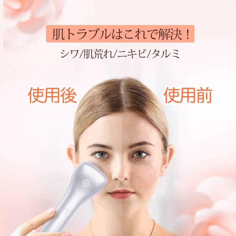 美顔器 超音波 イオン導入 導出 温熱美容器 汚れ除去 保湿成分浸透 肌ハリ たるみ ニキビ しわ 肌荒れ等 Usb充電式 Raku071 なんでも商店 通販 Yahoo ショッピング