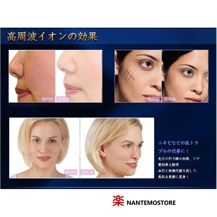 多機能美顔器 高周波電流 フェイスケア ヘアケア ニキビ跡除去 不眠症改善 4in1 携帯式 Skin Spot Remover 並行輸入 Xddlbhf003 なんでも商店 通販 Yahoo ショッピング