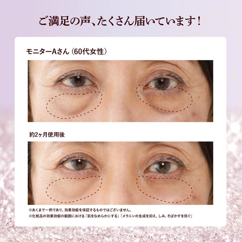 薬用BJレボリューションスティック 3g 美容美白スティック アイ