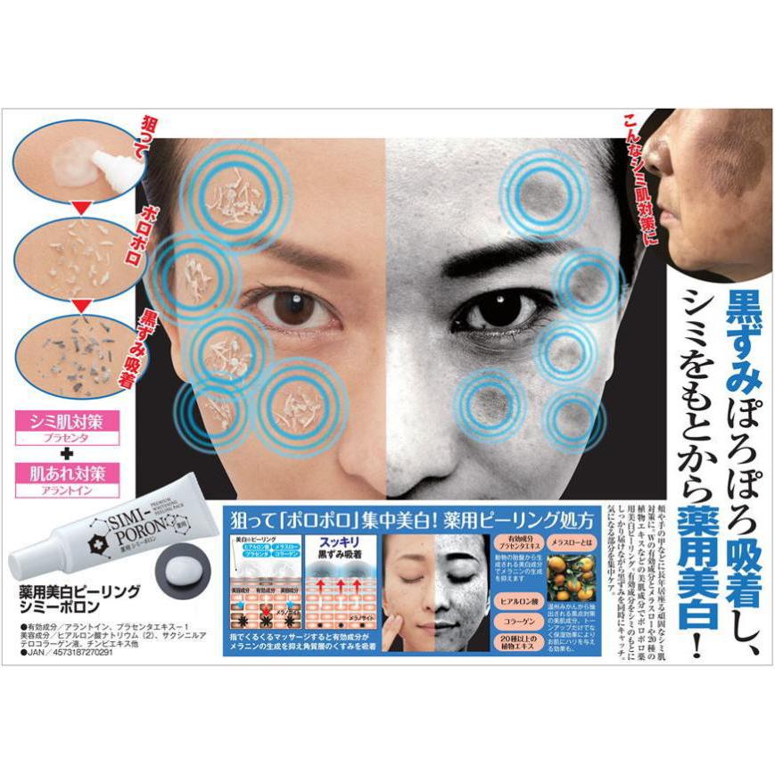 薬用シミーポロン 30g 医薬部外品 シミ取りクリーム シミ消し