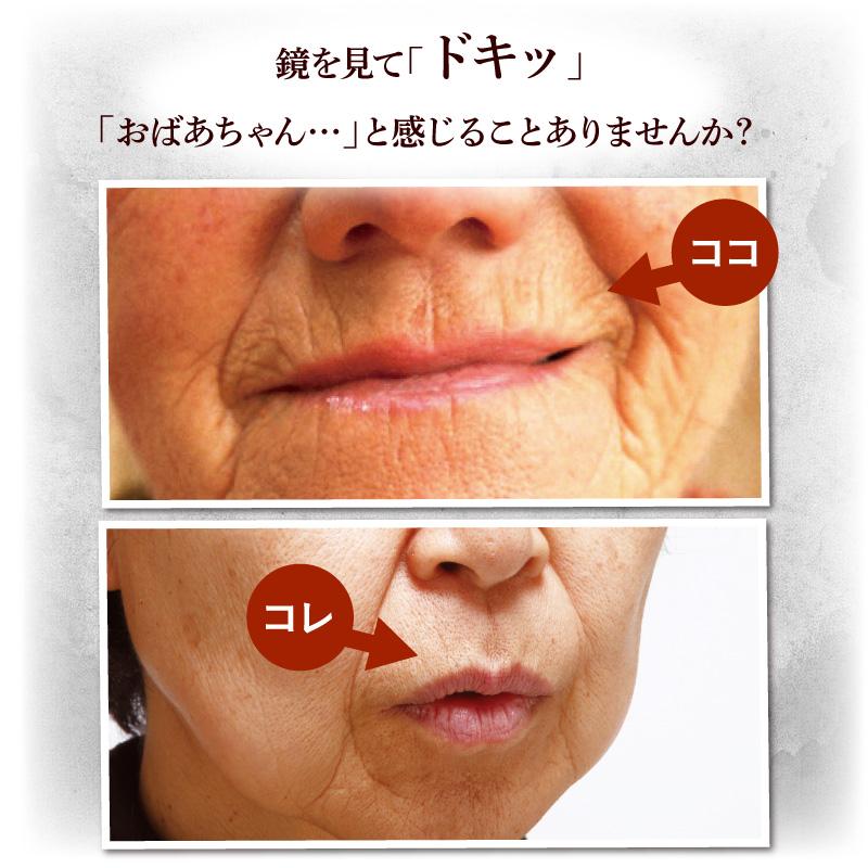 薬用シワトリンクル 40g シワ改善クリーム シワ伸ばしクリーム