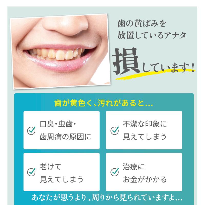 薬用YESホワイト 医薬部外品 100g ホワイトニング 歯磨き粉 口臭ケア