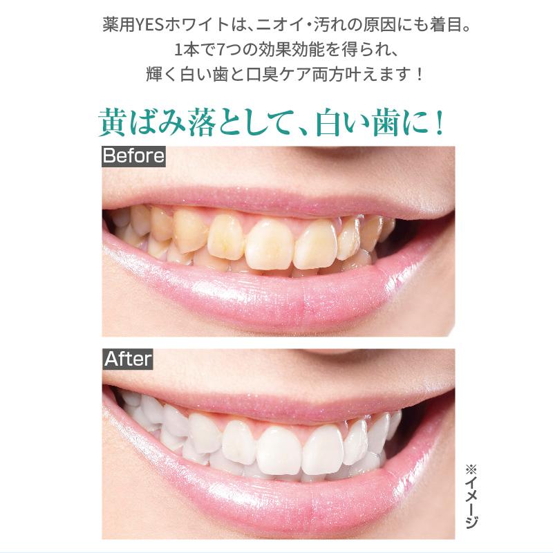 薬用YESホワイト 医薬部外品 100g ホワイトニング 歯磨き粉 口臭ケア
