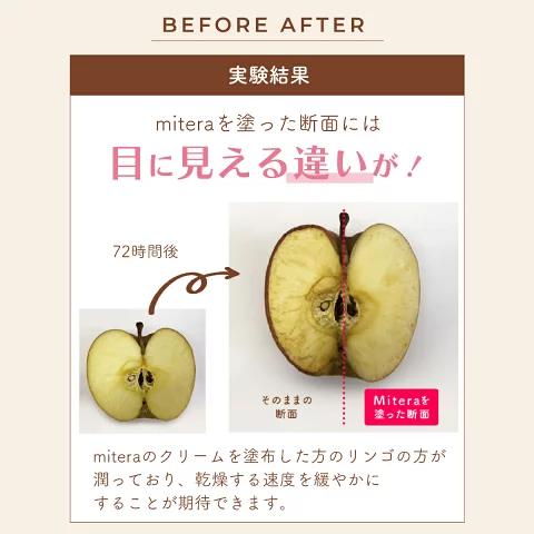 mitas 妊娠線クリーム ボディクリーム mitera 1本 1か月分 無 mitas 妊娠線クリーム ボディクリーム mitera 1本 1か月分 無