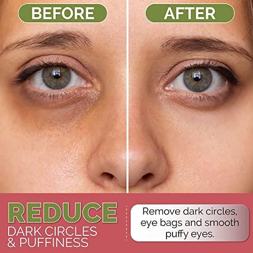 アンダーアイパッチ (濃円用) 黄斑黄斑目用リンクル (黄斑眼用) 黄斑眼用アンチリンクル (ヒアルロン酸・コラーゲンハイドロゲルアイゲルパッド) 黄斑%プレ アンダーアイパッチ 濃円用 黄斑黄斑目用リンクル 黄斑眼用 黄斑眼用アンチリンクル ヒアルロン酸 コラーゲンハイドロゲルアイゲルパッド