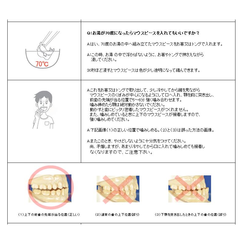 マウスピース 自分で作る いびき対策 マウスピース キット Kgot 0186 Kgot 0186 ひろしまど真ん中市場 通販 Yahoo ショッピング