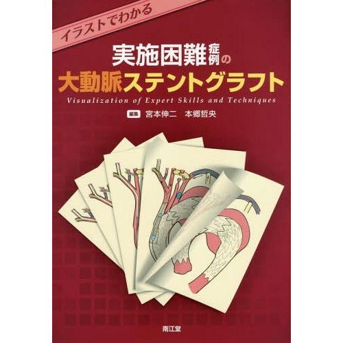 レビューで送料無料 本 雑誌 イラストでわかる実施困難症例の大動脈ステントグラフト Visualization Of Expert Skills And Techni 人気no 1 本体 Studiostodulky Cz