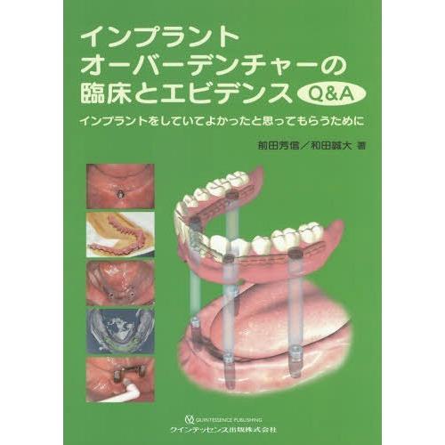 【送料無料】[本/雑誌]/インプラントオーバーデンチャーの臨床とエビデンスQ\u0026A インプラントをしていてよかったと思