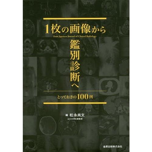  【M91RTKT0QPE】 限定デザイン