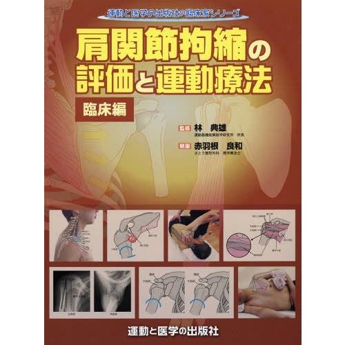 送料無料】[本/雑誌]/肩関節拘縮の評価と運動療法 臨床編 (運動