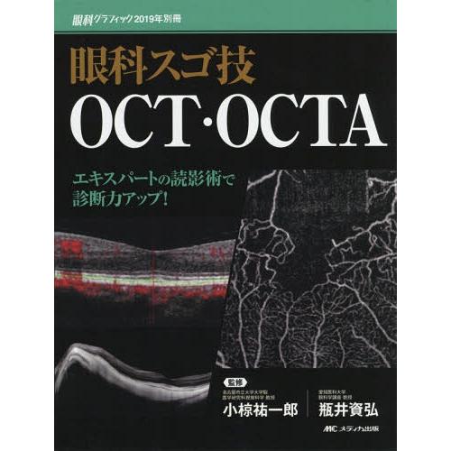 本/雑誌]/眼科スゴ技OCT・OCTA エキスパートの読影術で診断力アップ