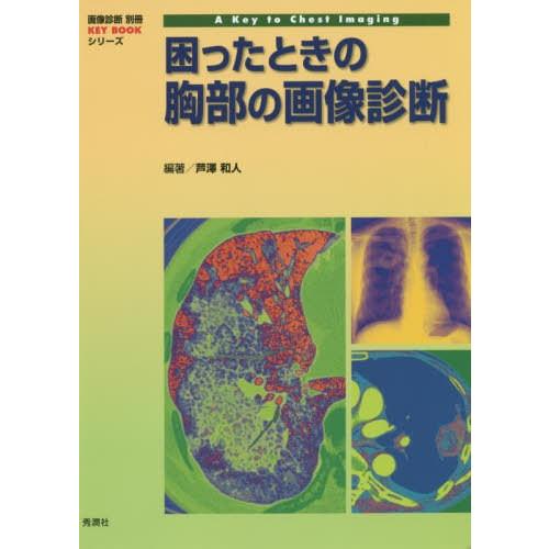 [【即日発送】 ] MOIJM1KWSG8 (MOIJM1KWSG8)