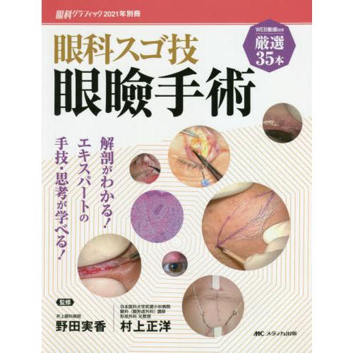 本/雑誌]/眼科スゴ技眼瞼手術 WEB動画付き厳選35本 解剖がわかる