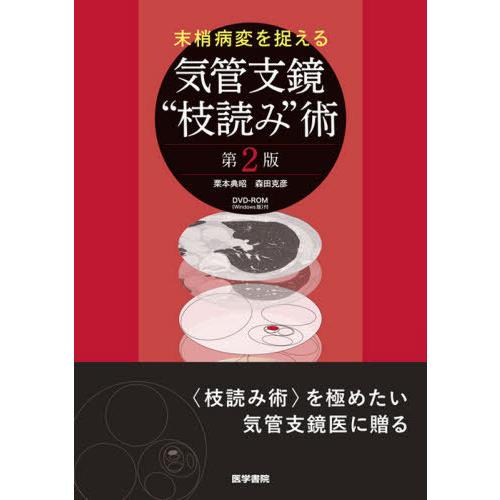 【送料無料】[本/雑誌]/末梢病変を捉える気管支鏡“枝読み”術/栗本典昭/著 森田克彦/著｜neowing