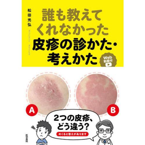 【送料無料】[本/雑誌]/誰も教えてくれなかった皮疹の診かた・考えかた Web動画付/松田光弘/著｜neowing