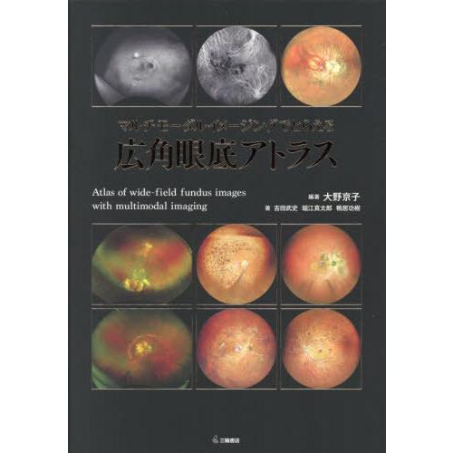 送料無料】[本/雑誌]/マルチモーダルイメージングでとらえる広角眼底 