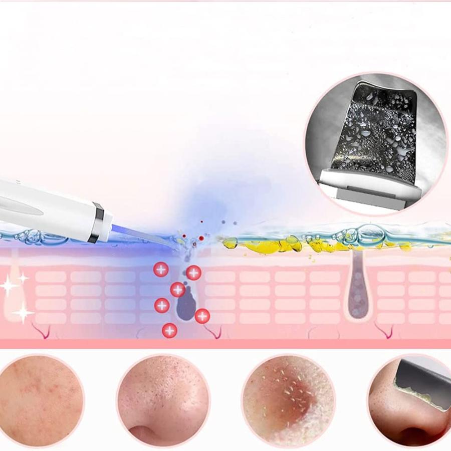 ウォーターピーリング 超音波ピーリング 小鼻 毛穴ケア 角質とり 赤青光エステ イオン ems ピーリング クレンジング 超音波美顔器 軽量｜newpark｜07