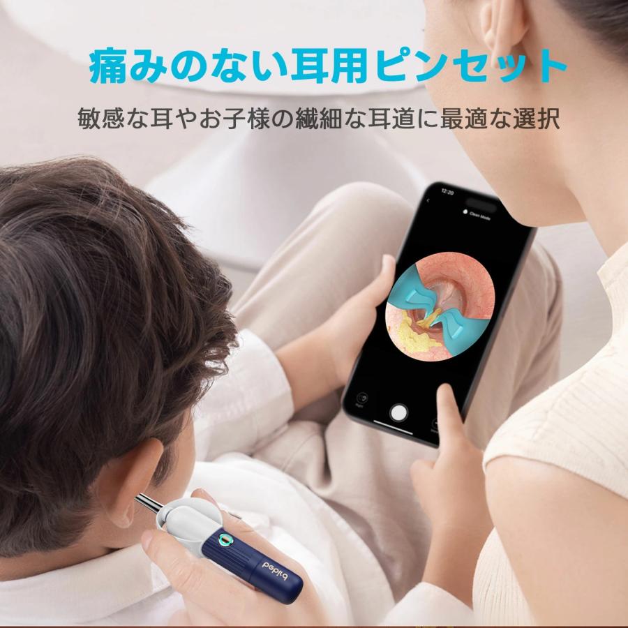 【新品】耳かき カメラ　1000万画質　スマホ　写真　BEBIRD BEBIRD耳かきカメラ1000万画質、極細で安心