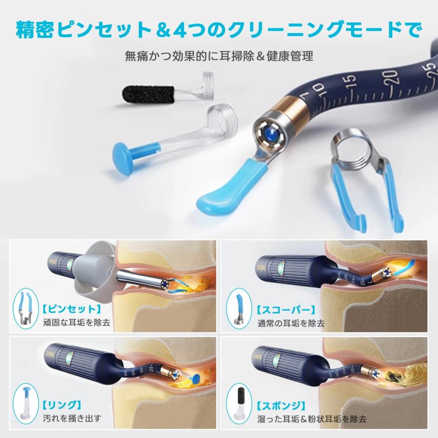 耳かき カメラ付き 1000万画質 BEBIRD カメラ付き耳かき フレキシブル