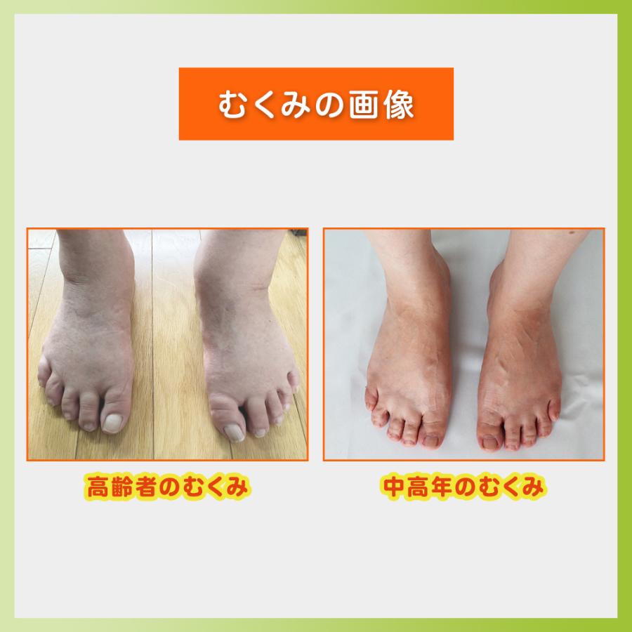 浮腫み　靴下　グーパー体操スッキリ　高齢者靴下　浮腫　解消器具　足の甲むくみ　酷い　ひどい　脚のむくみ対策　 治る！グーパーソックス |  | 05