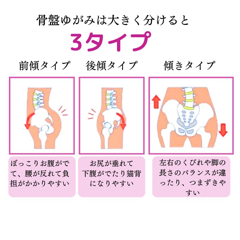ショーツ レディースショーツ 骨盤ショーツ ガードル 骨盤補正 姿勢矯正 敏感肌 ヒップアップ 補正下着 骨盤 |  | 08