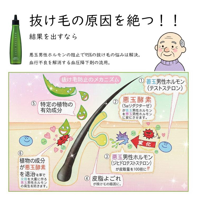 マミヤン アロエ薬用トニック 150ml 薬用トニック 医薬部外品 育毛