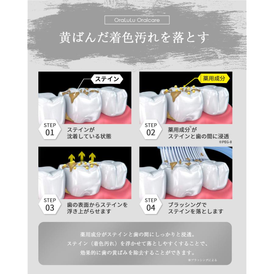 380円offクーポン モンドセレクション金賞受賞 ホワイトニング 歯磨き粉 歯を白くする 口臭 虫歯予防 150g大容量 医薬部外品 Oralulu オーラルル Tooth Paste Astyshop 通販 Yahoo ショッピング