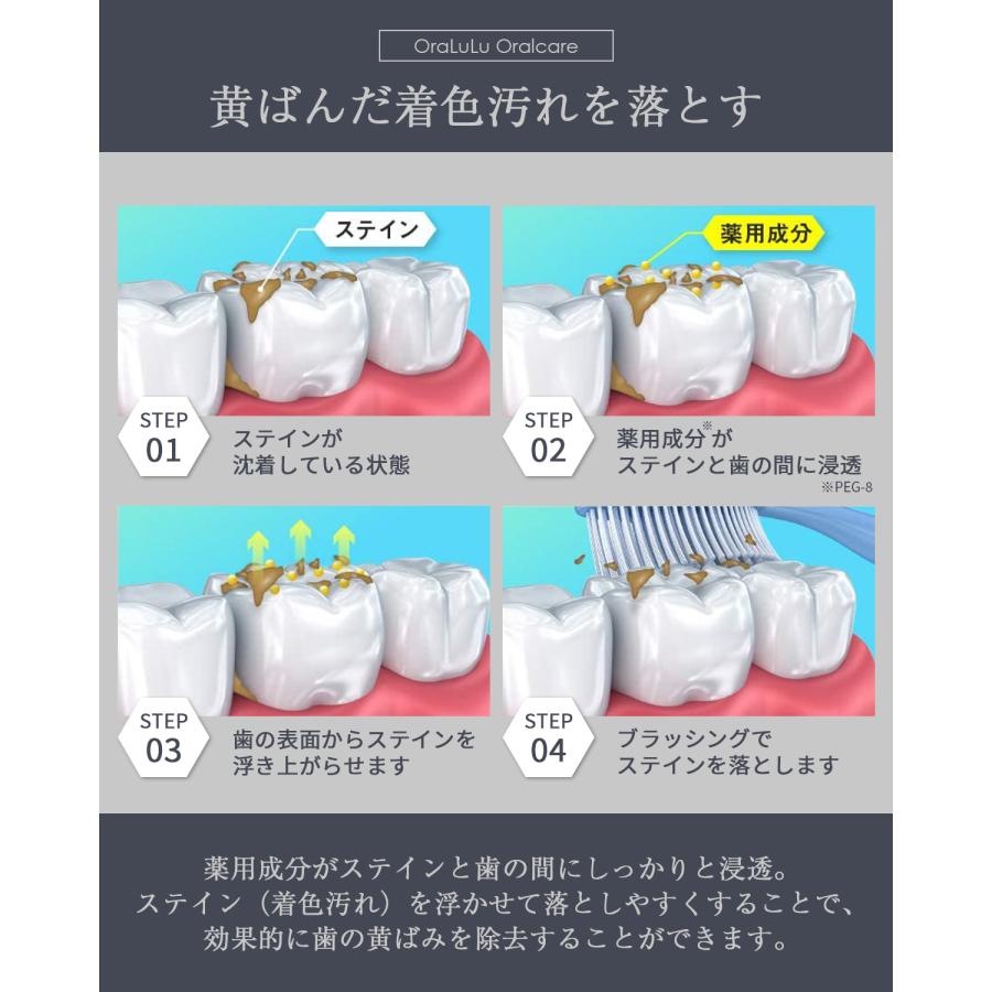 380円OFFクーポン」モンドセレクション金賞受賞 ホワイトニング 歯磨き粉 歯を白くする 口臭 虫歯予防 150g大容量 医薬部外品 OraLuLu( オーラルル) :10669-tooth-paste:ASTYSHOP - 通販 - Yahoo!ショッピング 380円OFFクーポン」モンドセレクション金賞受賞 ホワイトニング 歯磨き粉 歯を白くする 口臭 虫歯予防 150g大容量 医薬部外品 OraLuLu( オーラルル) :10669-tooth-paste:ASTYSHOP - 通販 - Yahoo!ショッピング