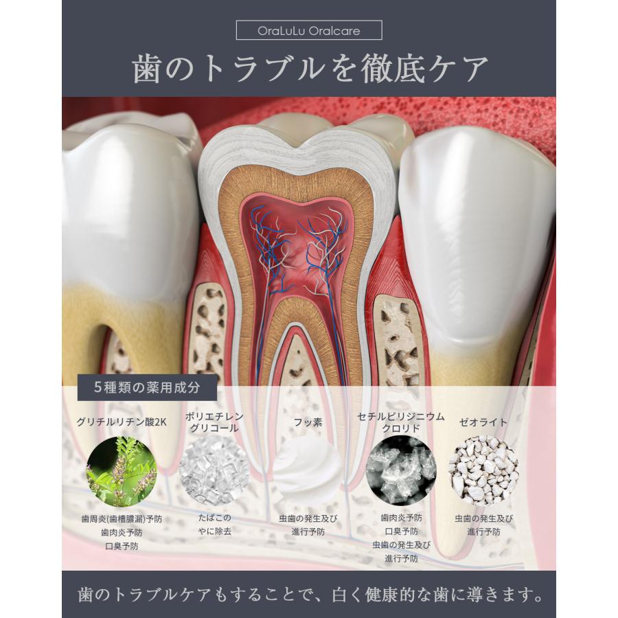 380円OFFクーポン」モンドセレクション金賞受賞 ホワイトニング 歯磨き粉 歯を白くする 口臭 虫歯予防 150g大容量 医薬部外品 OraLuLu( オーラルル) :10669-tooth-paste:ASTYSHOP - 通販 - Yahoo!ショッピング 380円OFFクーポン」モンドセレクション金賞受賞 ホワイトニング 歯磨き粉 歯を白くする 口臭 虫歯予防 150g大容量 医薬部外品 OraLuLu( オーラルル) :10669-tooth-paste:ASTYSHOP - 通販 - Yahoo!ショッピング