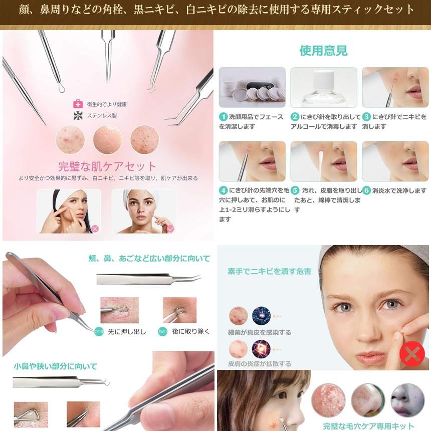 ニキ美人 極上の5本セット ニキビ取り 黒ニキビ除去 毛穴 ケア キット 黒ずみ取り 毛穴 角栓 高精度 Mnikibizin Mf1001 17a Next Stage 通販 Yahoo ショッピング