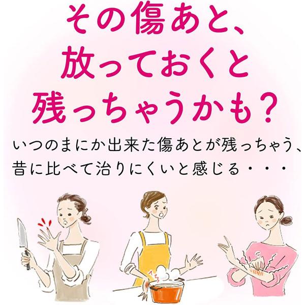 アットノン アットノンEX ジェル 15g 小林製薬 第2類医薬品 : ナイス