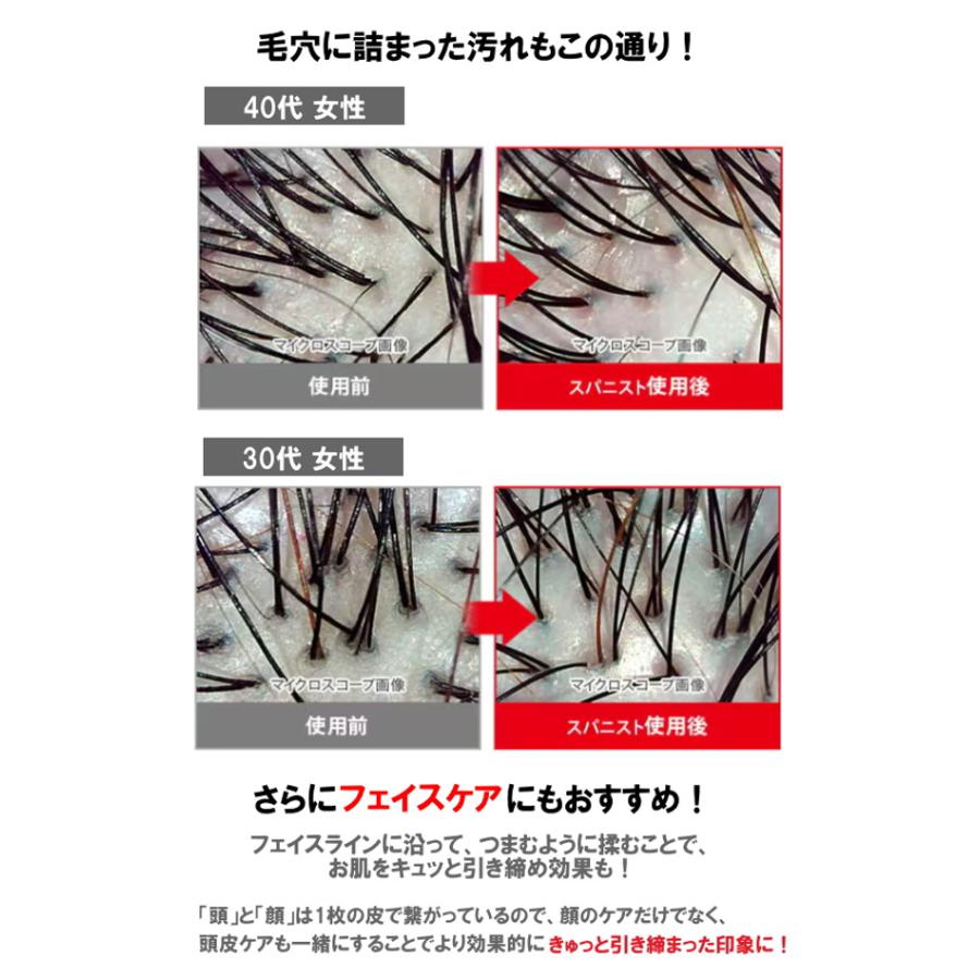 アデランス　スパニスト　プロ アデランス スパニストプロ ヘッドスパ 頭皮マッサージ