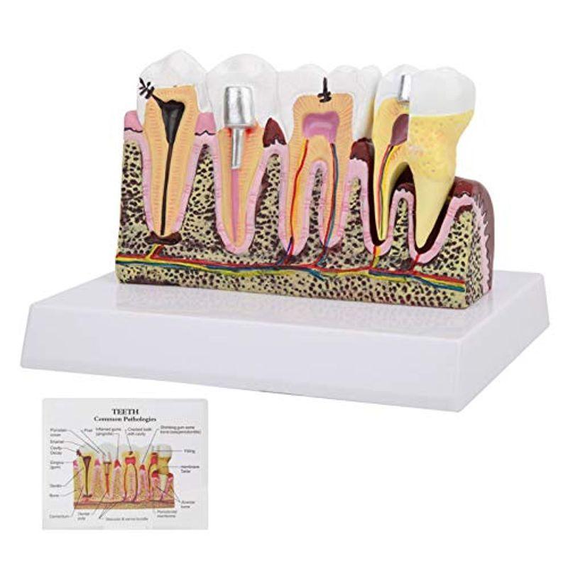 歯型 歯列 模型 口腔歯科模型 実用性 直感観察 変形にくい 無毒 学生や患者などに向け 教育用品 歯科医用品 歯おもちゃ 患者教育 歯科手  :20220131171850-00992:NIINAPHARM - 通販 - Yahoo!ショッピング